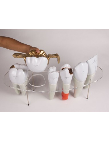 Erler Zimmer, modello anatomico di...