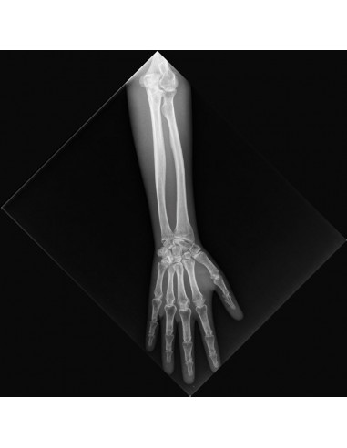 Simulatore per radiologia - Braccio -...