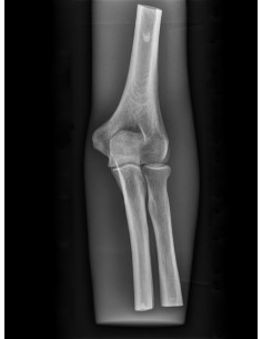 Erler Zimmer, modello...