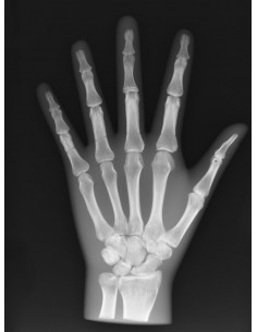 Simulatore per radiologia -... 2