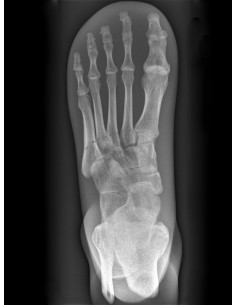 Erler Zimmer, modello...