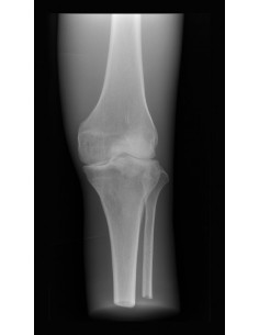 Erler Zimmer, modello... 2