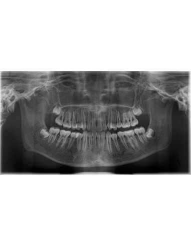 Erler Zimmer, modello anatomico di...