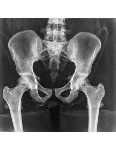Erler Zimmer, modello anatomico di...