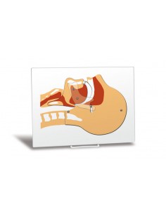 Simulatore per respirazione...