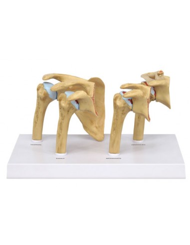 Erler Zimmer, modello anatomico di 4...