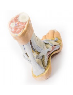 Dissezione superficiale e...