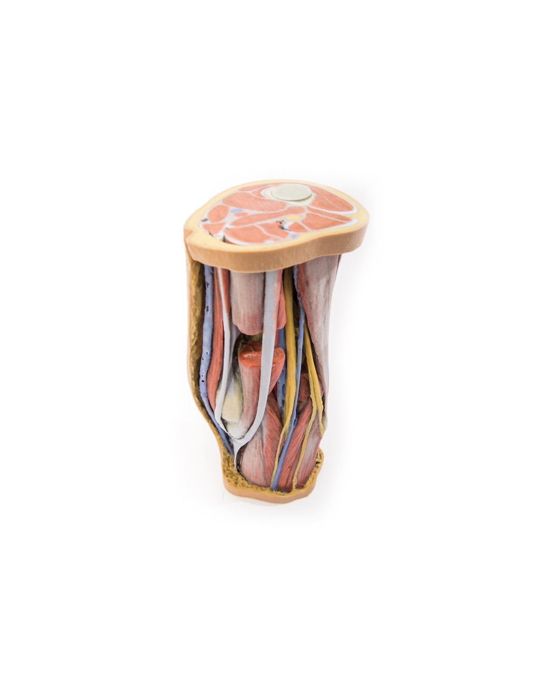 Dissezione profonda della Fossa... Dissezione profonda della Fossa...