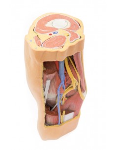 Fossa Poplitea con distale...