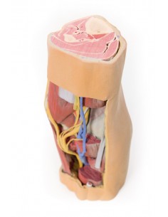 Fossa Poplitea con distale... 2