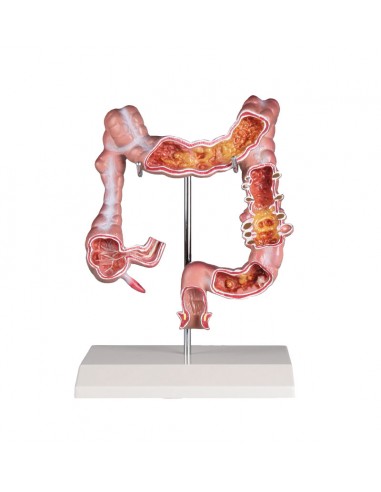 Erler Zimmer, Modello anatomico...