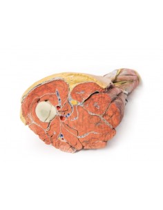 Dissezione della... 2