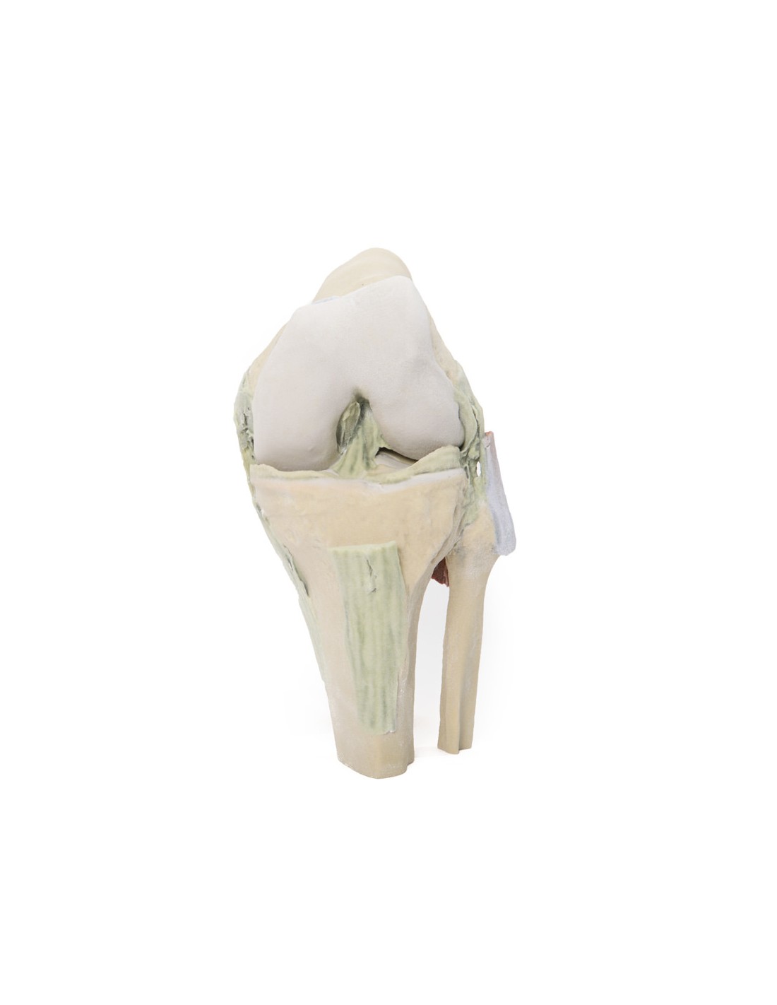 Articolazione del ginocchio, flessa -... Articolazione del ginocchio, flessa -...