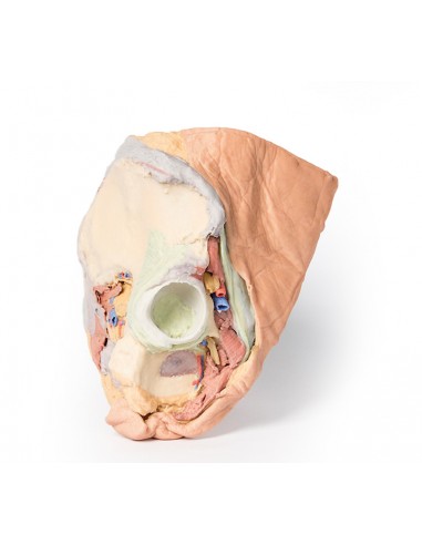 Dissezione del Bacino destro... Dissezione del Bacino destro...