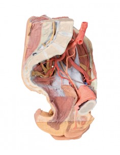 Bacino sinistro femminile e...