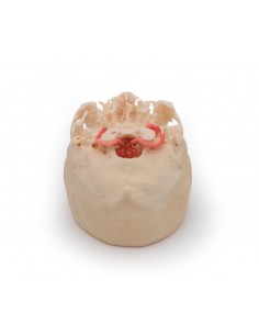 Poligono di Willis (circolo...