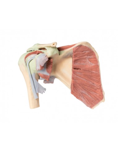 Dissezione profonda di un cingolo...