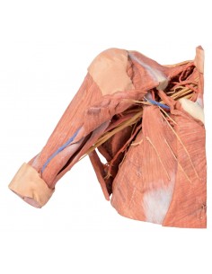 Dissezione della parete...