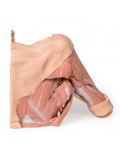 Dissezione della parete... 2