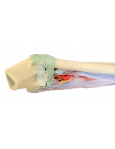 Dissezione profonda... 2