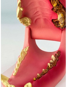 Mascella di Cane, a... 2