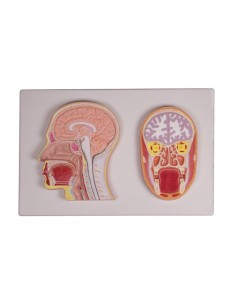 Erler Zimmer, sezione...