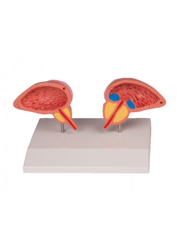 Erler Zimmer, modello anatomico di...